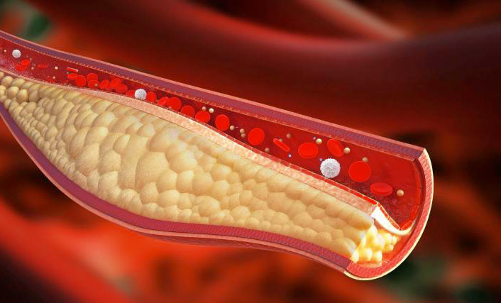 Colesterol: principales funciones y riesgos de exceso en la sangre